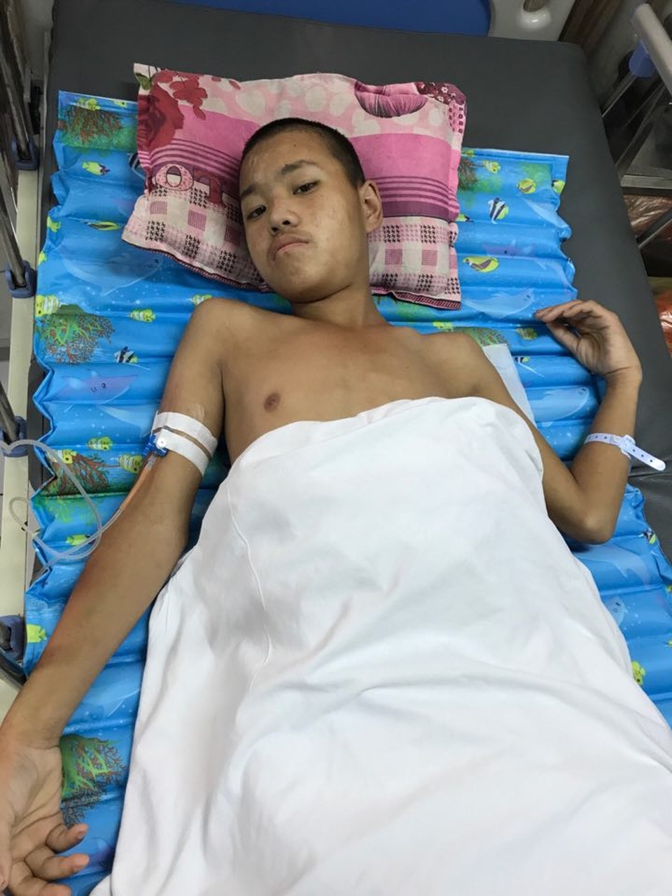 Gần 290 triệu đồng đến với em Cử Mí Ná - 1 Nhờ sư giúp đỡ của bạn đọc Dân trí và các bác sĩ, Ná đã được phẫu thuật sau đó chuyển sang Viện Bỏng quốc gia điều trị.