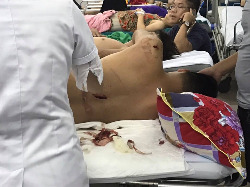 Vụ nam thanh niên bị côn đồ bịt mặt truy sát: Thêm 2 nghi can trình diện - 2 Nạn nhân Liêm bị chém nhiều nhát, bị thương nặng.