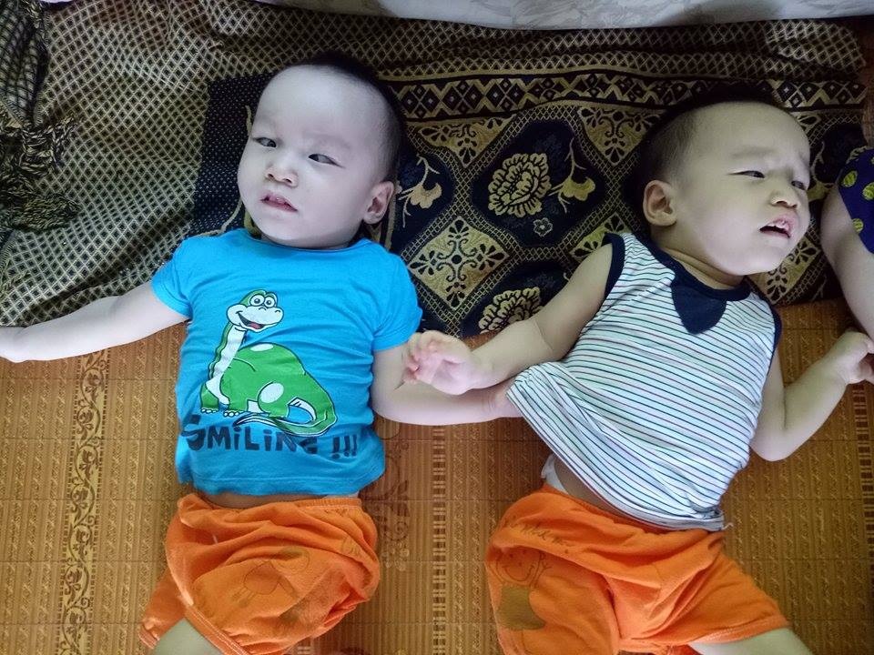 Mẹ đau đớn khi hai con song sinh bị bại não - 1 Hai đứa trẻ song sinh chỉ nằm một chỗ trong vô thức