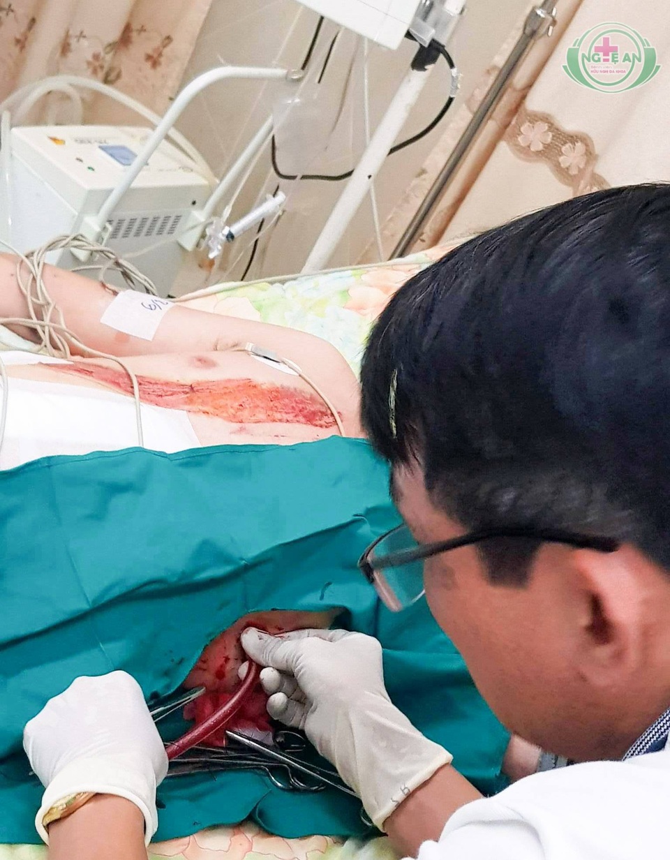 “Vượt biên” cứu bệnh nhân bị tai nạn nằm trước cửa tử - 2 Vừa sang đến nơi, các bác sỹ BVHNĐK Nghệ An bắt tay vào công việc cứu người ngay lập tức.