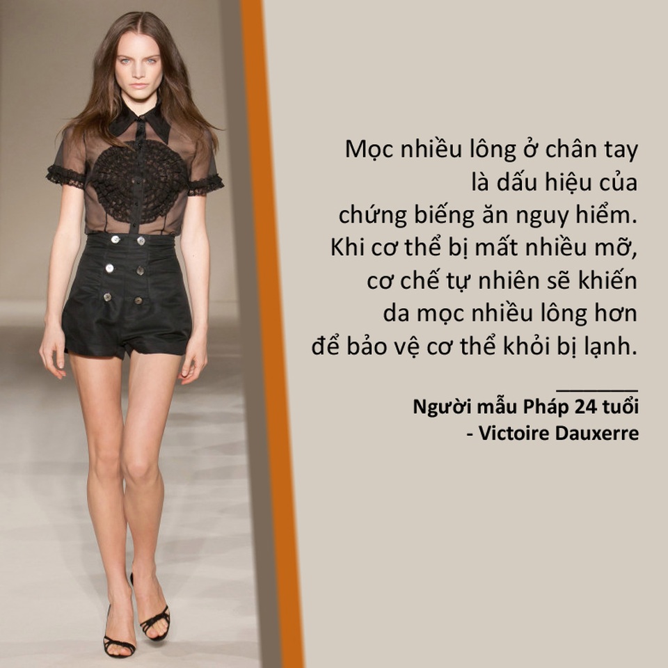 Góc khuất đáng sợ của việc người mẫu ép cân - 4 Góc khuất đáng sợ của việc người mẫu ép cân - 4