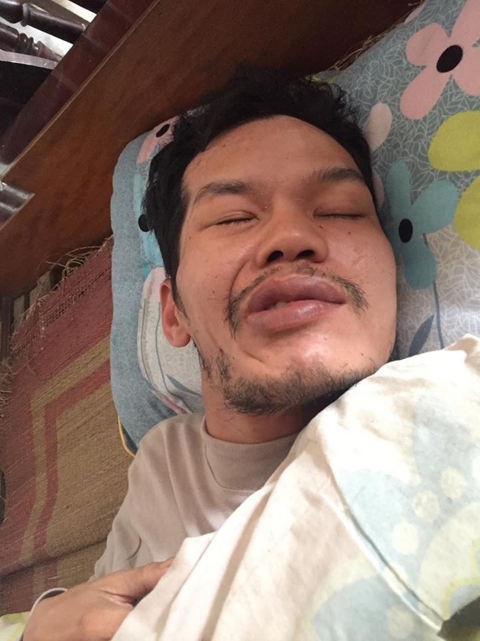 Mẹ bỏ đi, bố bị u não, bé gần 5 tháng tuổi ngằn ngặt khóc vì khát sữa - 2 Căn bệnh u não khiến người đàn ông mới 31 tuổi trở nên kiệt quệ.