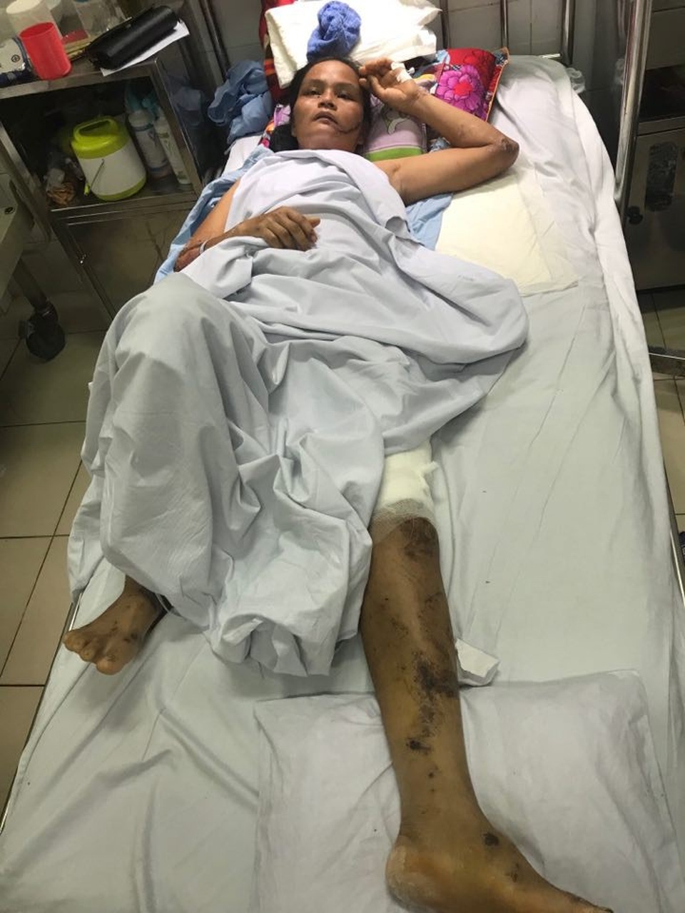 Chồng chết, vợ nguy kịch vì lũ cuốn trôi - 1 Bị lũ cuốn trôi, khiến chồng chị Phiếu mất mạng còn chị phải cấp cứu trong tình trạng đa chấn thương.