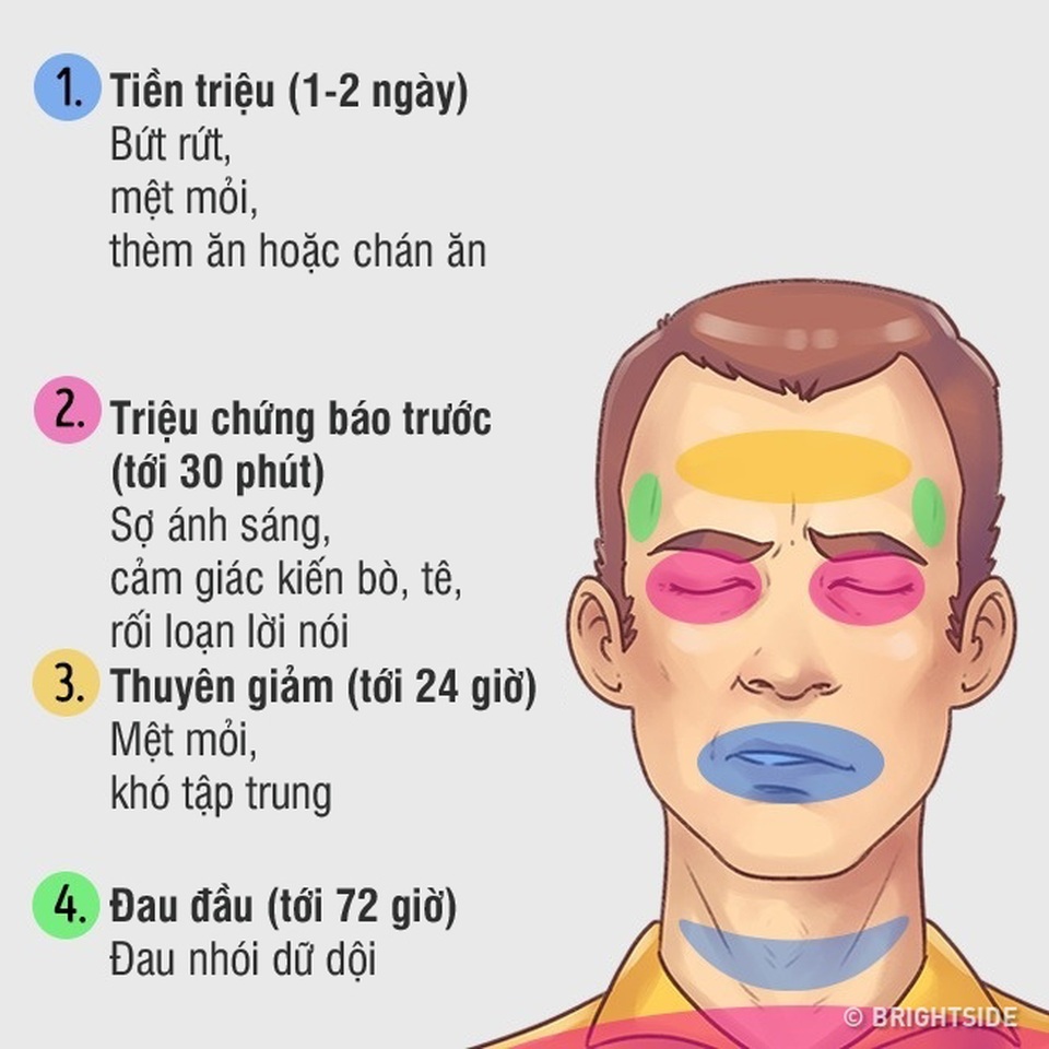 Ứng phó hiệu quả 5 kiểu đau đầu hay gặp - 3 Ứng phó hiệu quả 5 kiểu đau đầu hay gặp - 3