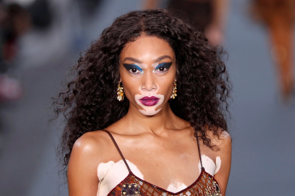 Người mẫu Canada bị bệnh bạch biến - Winnie Harlow - tự tin sải bước trên sàn catwalk đặt trên đại lộ Champs Elysees, trong khuôn khổ Tuần lễ Thời trang Paris (Pháp). (Ảnh chụp ngày 1/10)