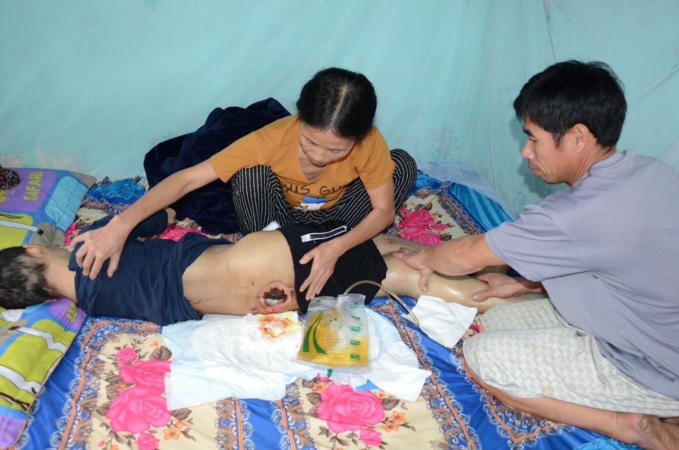 Tiếng kêu cứu ai oán của người mẹ nghèo xin được cắt chân cho con - 4
Thương con đứt từng khúc ruột, nhưng bố mẹ nghèo chỉ còn biết thay nhau bóp chân cho con đỡ đau đớn!