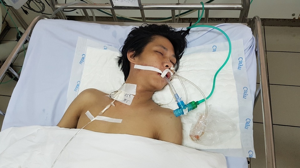 Thương tâm chàng trai không có cha mẹ nguy kịch vì viêm màng não - 1 Em Châu Đức Dũng hôn mê bất động trong nửa năm qua vì bệnh viêm màng não