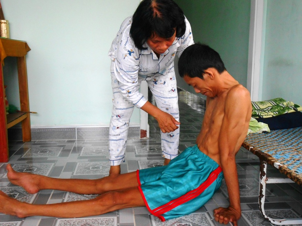 Bi kịch cả gia đình đều mắc bệnh teo rút chân tay - 4 Một mình chị gồng gánh gia đình