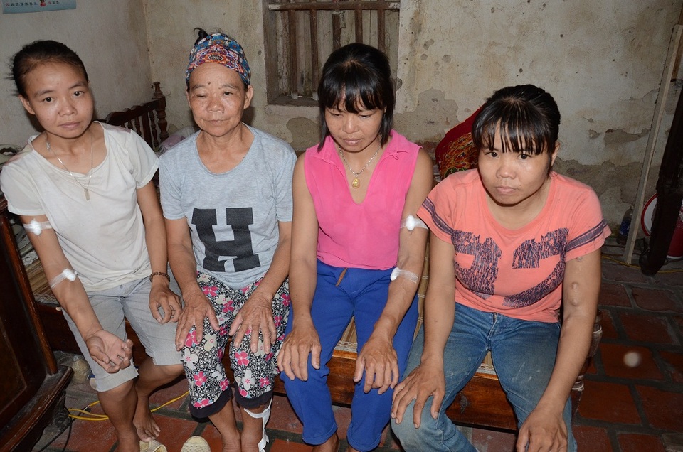 Đau xót gia đình cả 4 người con cùng mắc suy thận mãn - 6
Liệu có còn nỗi đau nào hơn thế! Sinh hạ 4 người con thì cả 4 đều lần lượt mắc suy thận mãn, người con trai cả đã ra đi mãi mãi, còn 3 cô con gái thì lay lắt sống nhờ tuần 3 lần chạy thận nhân tạo.