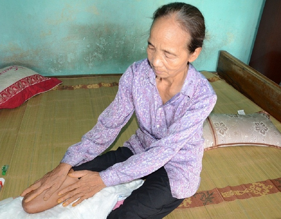 Đi thăm con trai bị tâm thần, mẹ gặp tai nạn phải cưa bỏ 1 chân - 6
Còn nỗi đau nào hơn với người phụ nữ bất hạnh này, chồng thì tâm thần bỏ nhà ra ngoài sống một mình, con trai thì mắc tâm thần phân liệt