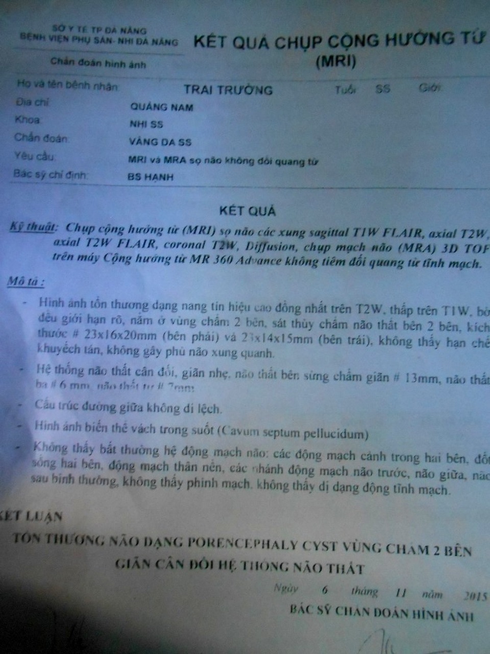 Xót thương cháu bé 2 tuổi bị tổn thương não và mất thính lực nặng - 8 Kết quả chụp cộng hưởng tổn thương não của cháu
