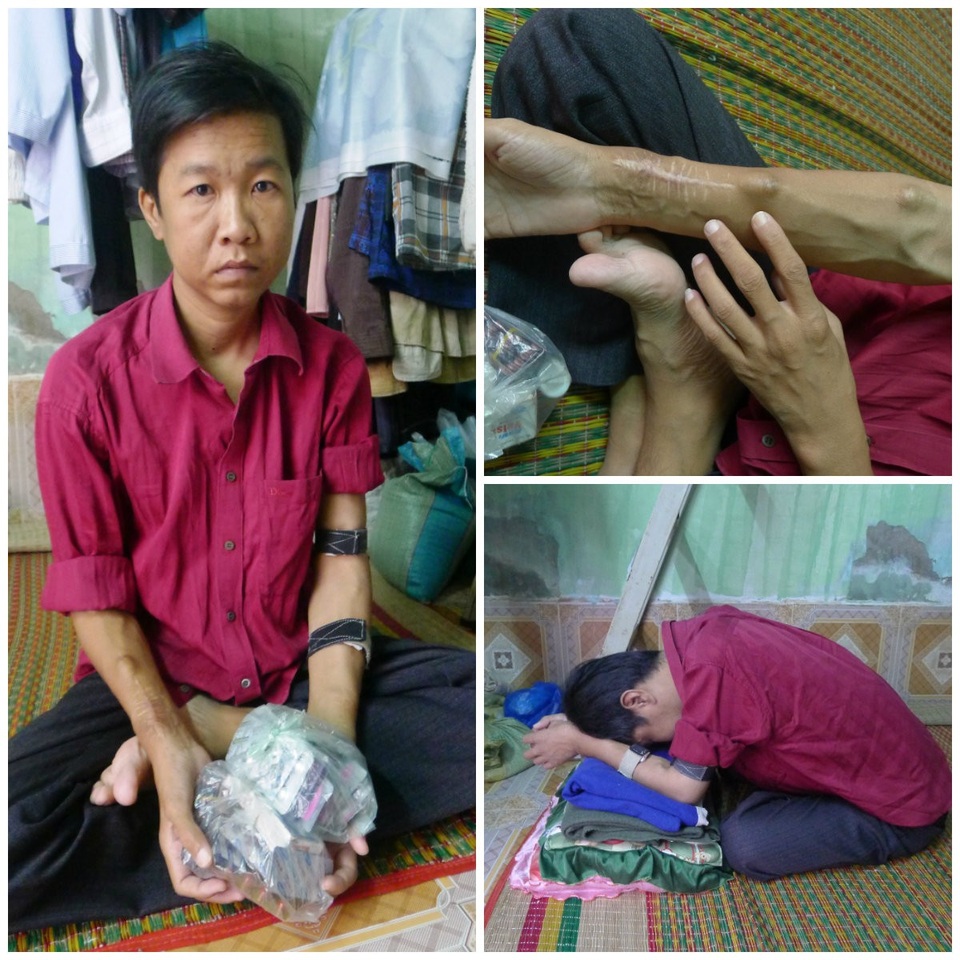 Anh Giảng Hoàng Đâu mang căn bệnh suy thận mãn đã 7 năm qua. Hiện nay nhiều đêm anh phải ngủ ngồi như thế này