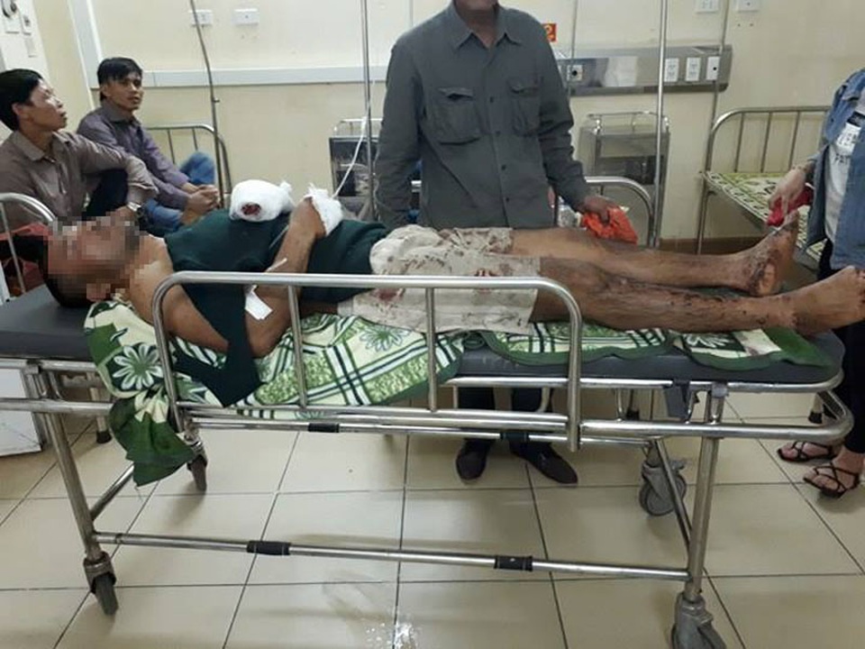 Dùng máy mài cắt đạn pháo, 2 anh em ruột thương vong - 1 Anh Lịnh đang được cấp cứu tại Bệnh viện ĐK Hà Tĩnh