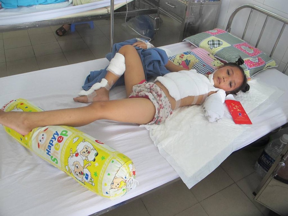 “Con nhớ tay con có 5 ngón, sao giờ không còn?” - 1 Sau tai nạn giao thông, cháu Minh Thư bị đa chấn thương đang được điều trị tại Bệnh viện Đà Nẵng