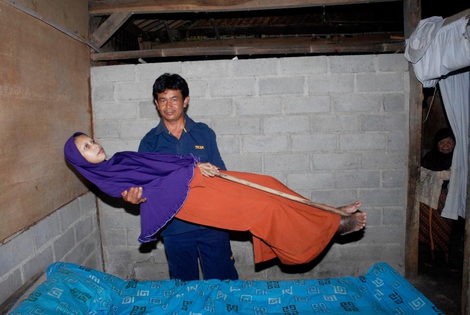 Căn bệnh lạ khiến cơ thể cô gái "cứng đơ như gỗ" - 1 Căn bệnh lạ khiến cơ thể cô gái "cứng đơ như gỗ" - 1