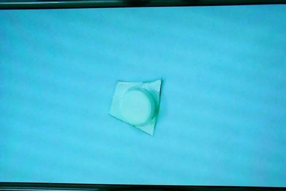Uống thuốc quên bóc vỉ, một phụ nữ nhập viện cấp cứu - 1 Viên thuốc chưa bóc vĩ được lấy từ thực quản bệnh nhân H.