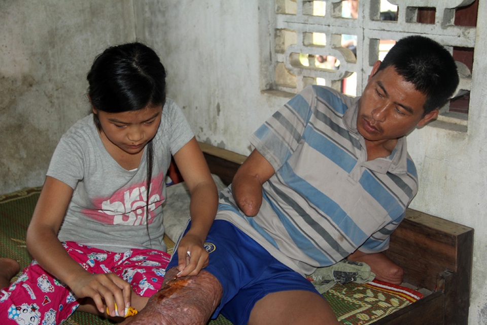 Cô bé cũng tự chăm sóc, vệ sinh vết thương cho người bố gặp nạn của mình.