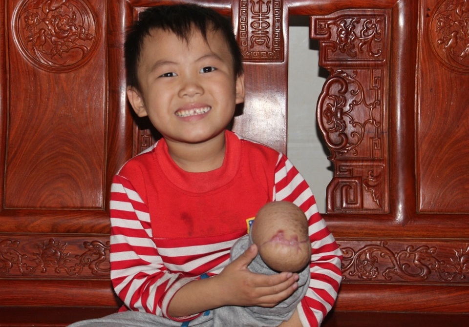 Công khai xin lỗi, hỗ trợ tiền cho cháu bé 5 tuổi bị cột viễn thông đè nát chân! - 1 Công khai xin lỗi, hỗ trợ tiền cho cháu bé 5 tuổi bị cột viễn thông đè nát chân! - 1
