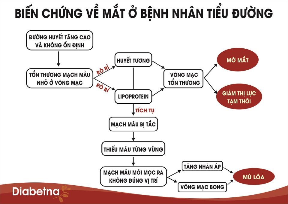 4 cách đơn giản giảm nguy cơ mù lòa ở bệnh nhân tiểu đường - 1
Tổn thương đáy mắt (võng mạc) có thể khiến người tiểu đường bị mù lòa