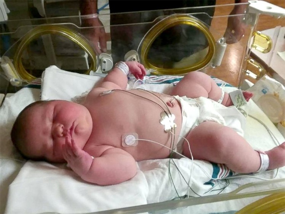 Bé sơ sinh khổng lồ ra đời ở Mỹ - 1
