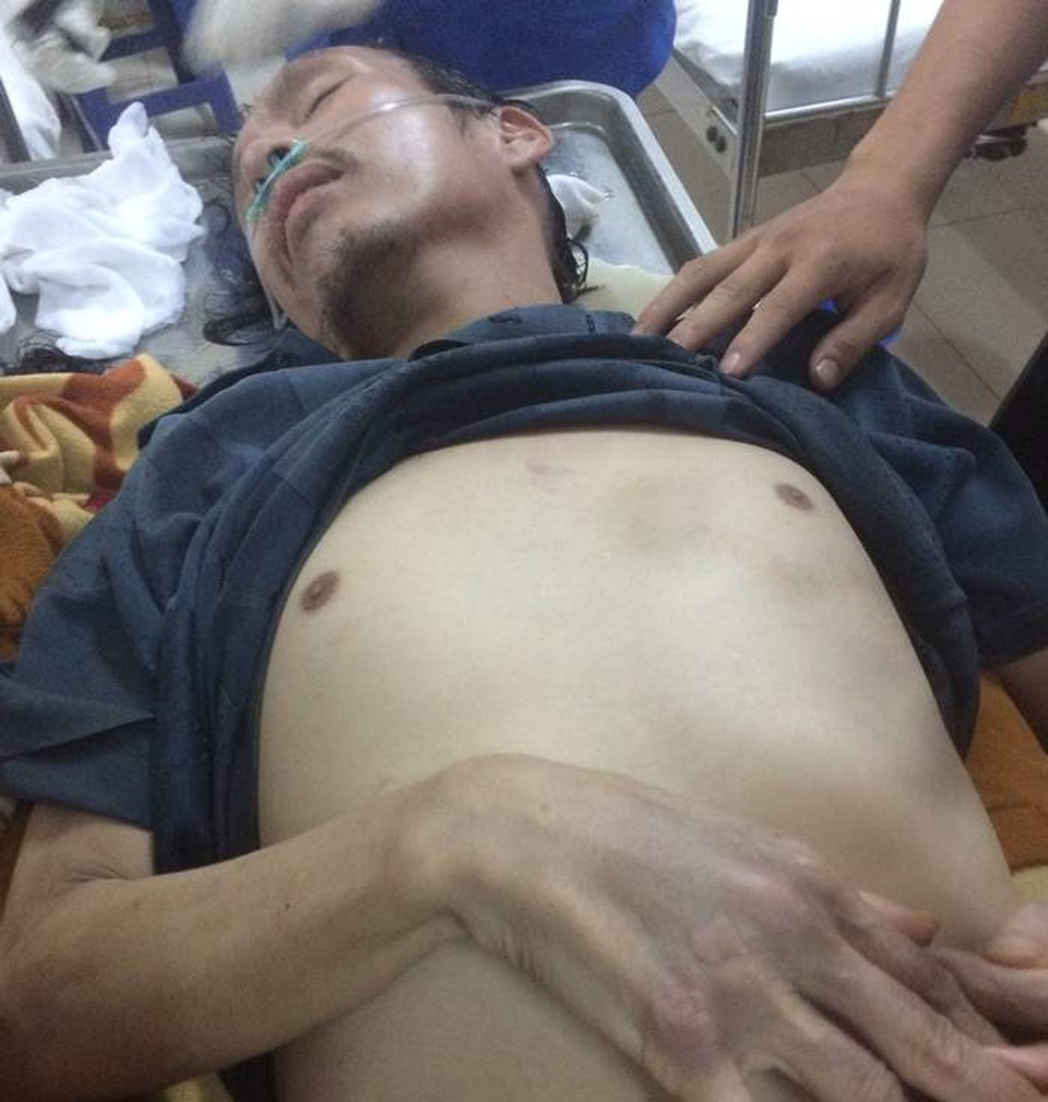 Người đàn ông nhập viện sau khi bị công an bắt tạm giam 1 ngày - 1
Anh Chiến phải nhập viện cấp cứu sau khi bị tạm giam 1 ngày