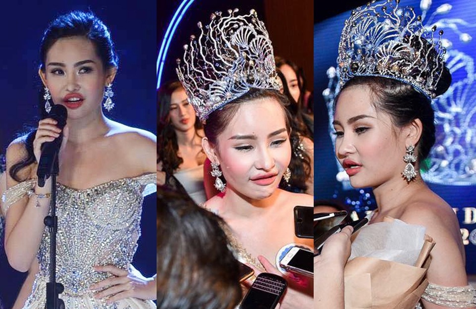 Tân Hoa hậu Đại dương khiến dư luận "sục sôi" tranh cãi, bàn tán - 2 Tuy nhiên, hình ảnh thực tế đôi môi không được tự nhiên ngay trong đêm chung kết của Ngân Anh được ghi lại vẫn là dấu hỏi lớn cho câu trả lời của Tân hoa hậu: “Hiện tại, tôi khẳng định gương mặt của tôi tự nhiên 100%”