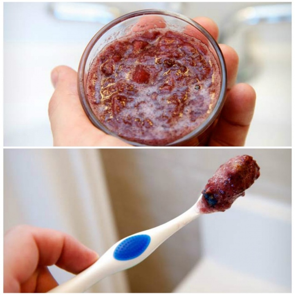 Mẹo chăm sóc răng miệng “tại gia” để có nụ cười trắng sáng - 2 Mẹo chăm sóc răng miệng “tại gia” để có nụ cười trắng sáng - 2