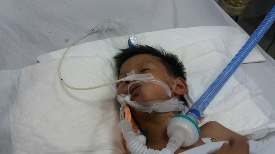 Bị ngã từ xe múc xuống đất, bé trai 7 tuổi nguy kịch - 1
Cháu Bảo bị chấn thương sọ não, chấn thương cột sống cổ... đang nằm điều trị tại Bệnh viện Đà Nẵng