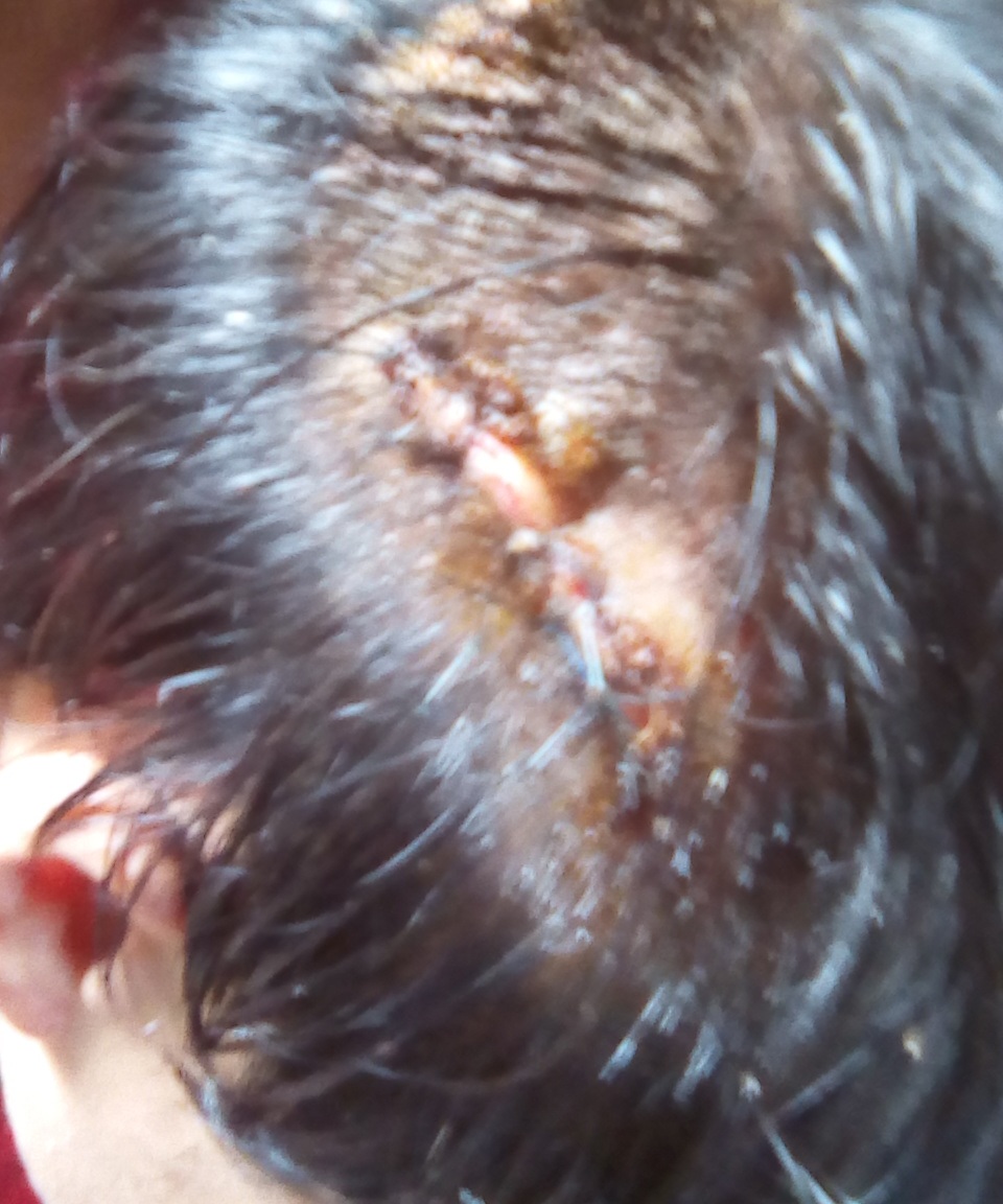 Khởi tố vụ trai làng hỗn chiến rạng sáng mùng 1 Tết - 1
Anh Vũ bị chém chấn thương vùng đầu và đứt tai (ảnh gia đình nạn nhân cung cấp)