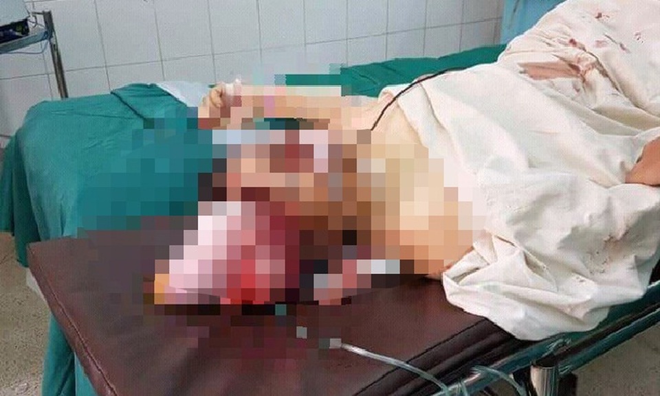 Mâu thuẫn gia đình, chồng dùng dao sát hại vợ rồi nhảy hồ tự tử - 1
Phát hiện sự việc, gia đình đã đưa chị Thúy đi cấp cứu trong tình trạng nguy kịch