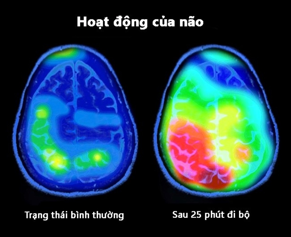 7 mẹo cải thiện tâm trạng theo các chuyên gia - 6 7 mẹo cải thiện tâm trạng theo các chuyên gia - 6