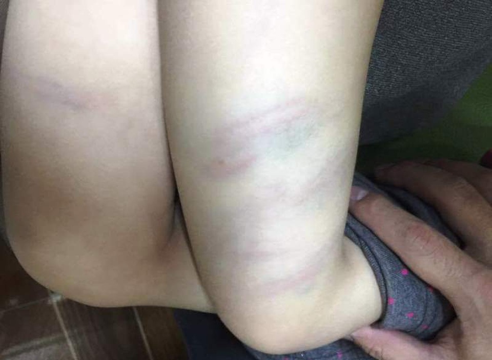 Chủ tịch thành phố “lệnh” chấn chỉnh hoạt động giáo dục sau vụ cô giáo đánh bé gái 2 tuổi - 2 Sau vụ học sinh bị đánh, Chủ tịch TP Thanh Hóa ra công văn chấn chỉnh hoạt động giáo dục trên địa bàn thành phố
