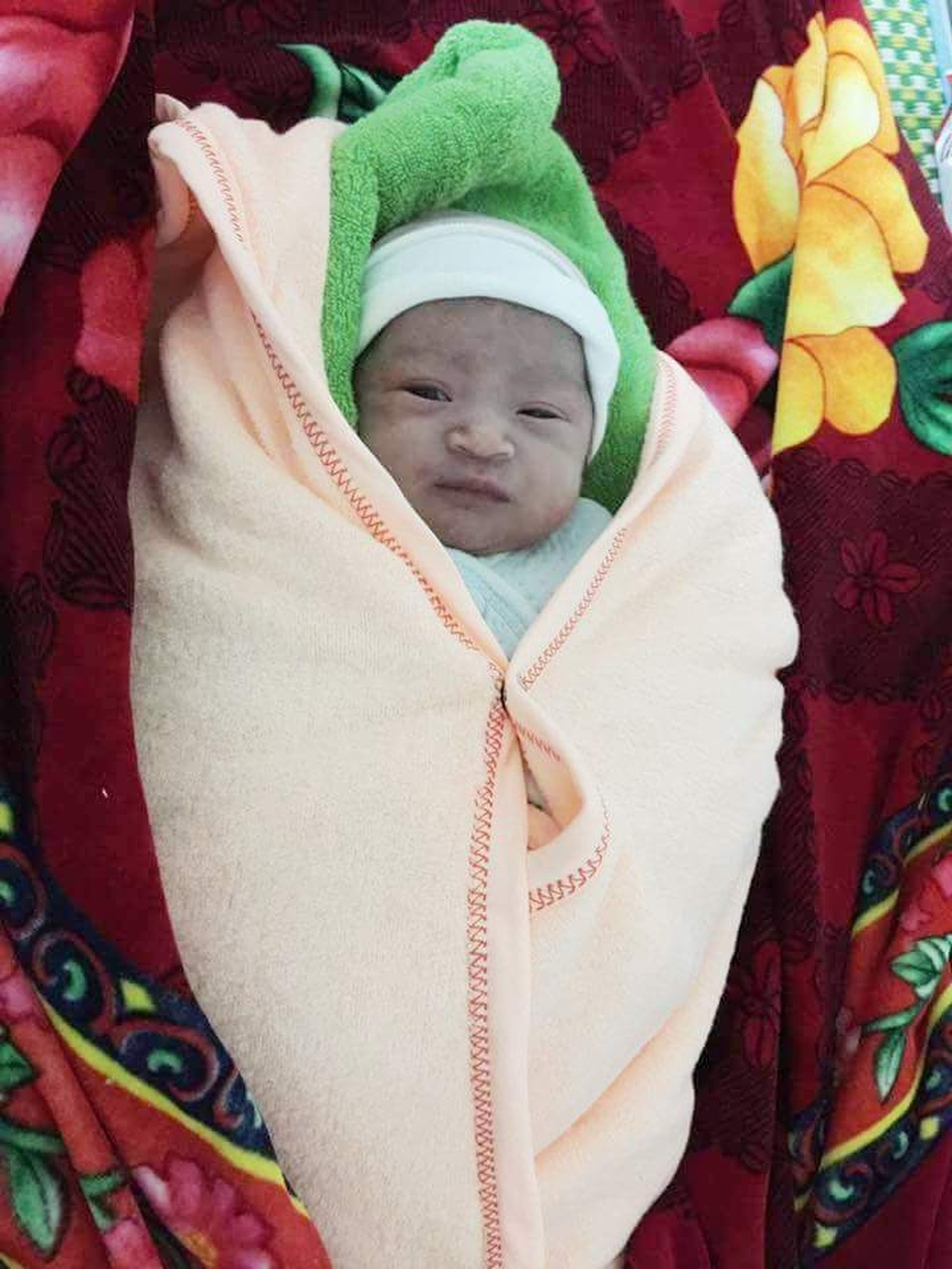 Cứu sống cháu bé sơ sinh bị sa dây rốn trong ngày Thầy thuốc Việt Nam - 1 Em bé trai nặng 3,3 kg được cứu sống, miệng nhoẻn cười đáng yêu
