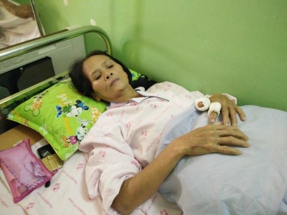 Cả nhà lao vào đánh chém hai vợ chồng hàng xóm như côn đồ - 5 Vợ ông Ba là bà Tốt cũng đang điều trị tại bệnh viện Hợp Lực