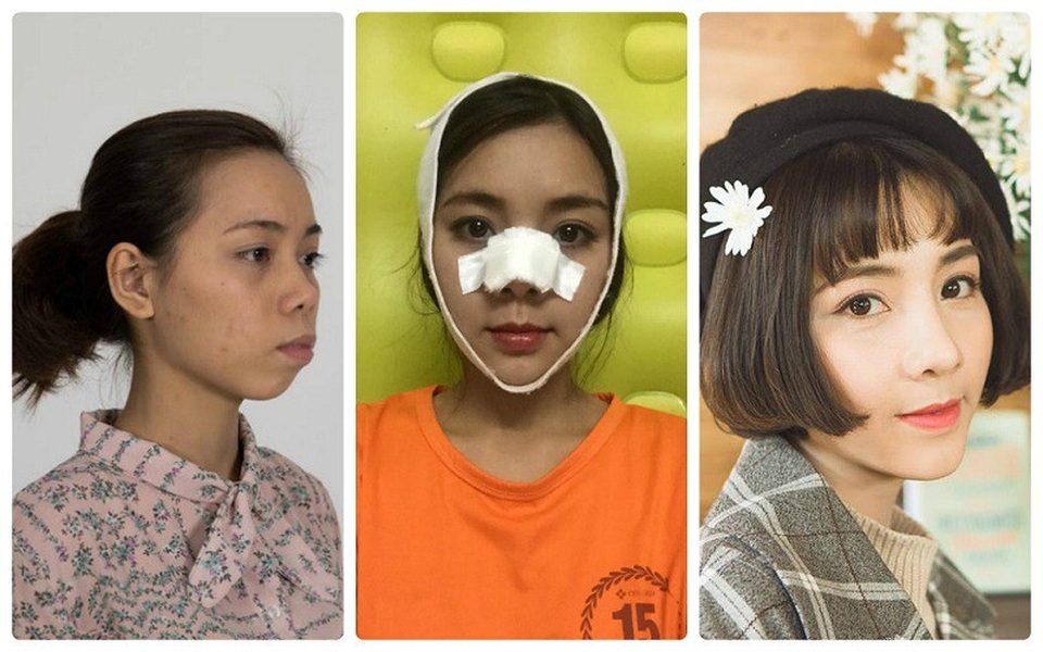 
Hình ảnh của Phượng trước và sau khi quyết định thay đổi diện mạo
