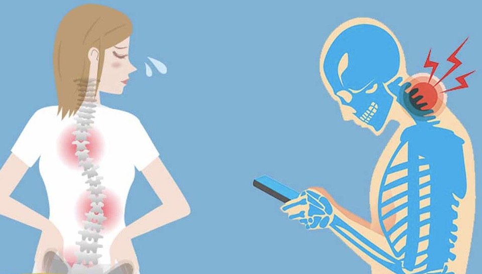 Cảnh báo: Cả một thế hệ trẻ sẽ bị biến dạng cổ do điện thoại thông minh - 2 Cảnh báo: Cả một thế hệ trẻ sẽ bị biến dạng cổ do điện thoại thông minh - 2
