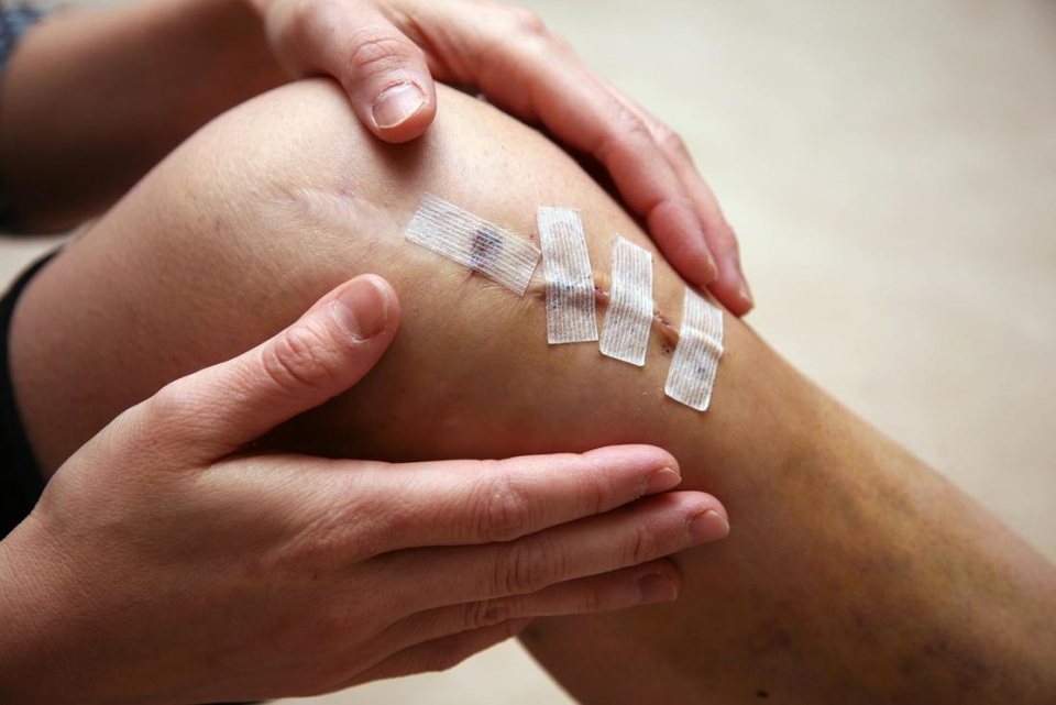 10 chấn thương hay gặp ở đầu gối và cách điều trị - 1 10 chấn thương hay gặp ở đầu gối và cách điều trị - 1