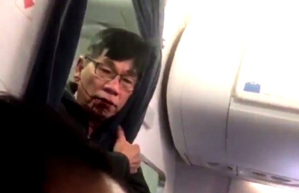 Hành khách gốc Việt khởi động thủ tục pháp lý kiện hãng hàng không United - 1
Ông David Dao (Ảnh chụp từ video)