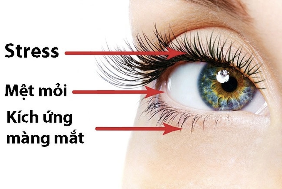 7 cách trị chứng giật mắt - 1 7 cách trị chứng giật mắt - 1