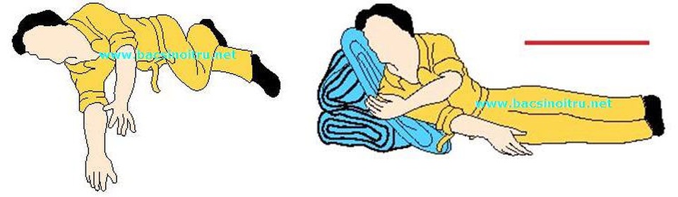 Khi bệnh nhân xuất hiện dấu hiệu bất thường về ý thức, vận động như nói khó, nói ngọng, liệt một bên... hãy đặt bệnh nhân ở tư thế nằm nghiêng đầu cao và kết nối đưa người bệnh đến cơ sở y tế sớm nhất. Ảnh: BSNT