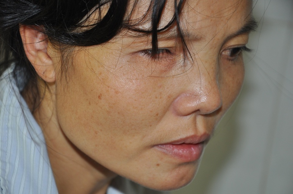 "Mẹ con sắp chết rồi, ai cứu mẹ con với !" - 7 Ca mổ của chị có khả năng phục hồi tốt vì buồng tim và chức năng tim còn tốt nhưng không lo được tiền, chị chắc chắn cái chết đến với mình.