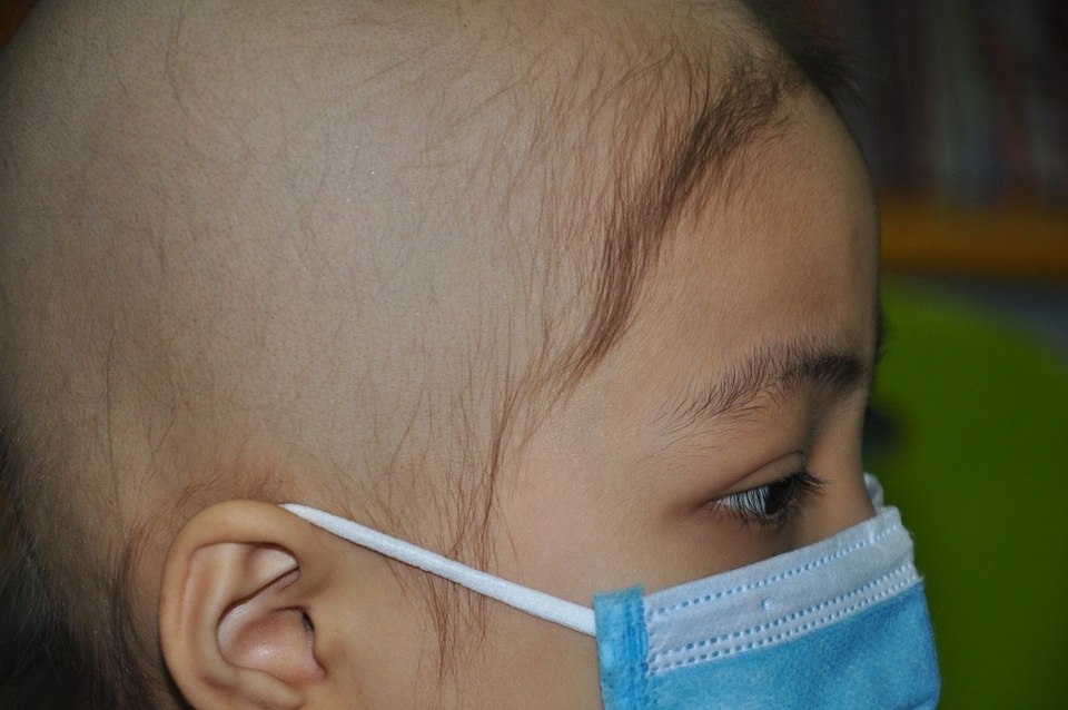 Cô bé Ngọc Ánh bị ung thư máu đã mãi mãi ra đi - 2 Căn bệnh quái ác khiến em phải nhập viện điều trị trong đau đớn.