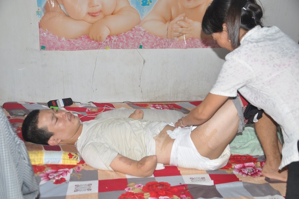 Em không tự chủ được trong việc vệ sinh nên phải đóng bỉm.