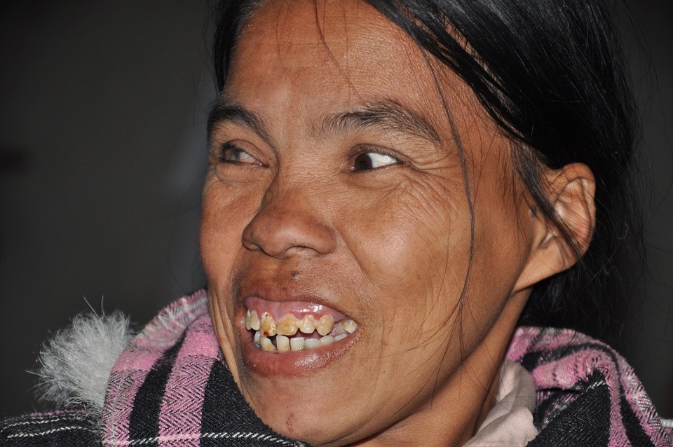 Thương cô bé học lớp 7 không có bố, chăm mẹ tâm thần - 2 Mẹ của Hương, chị Nguyễn Thị Kiều (sinh năm 1977) cả ngày ngồi cười.