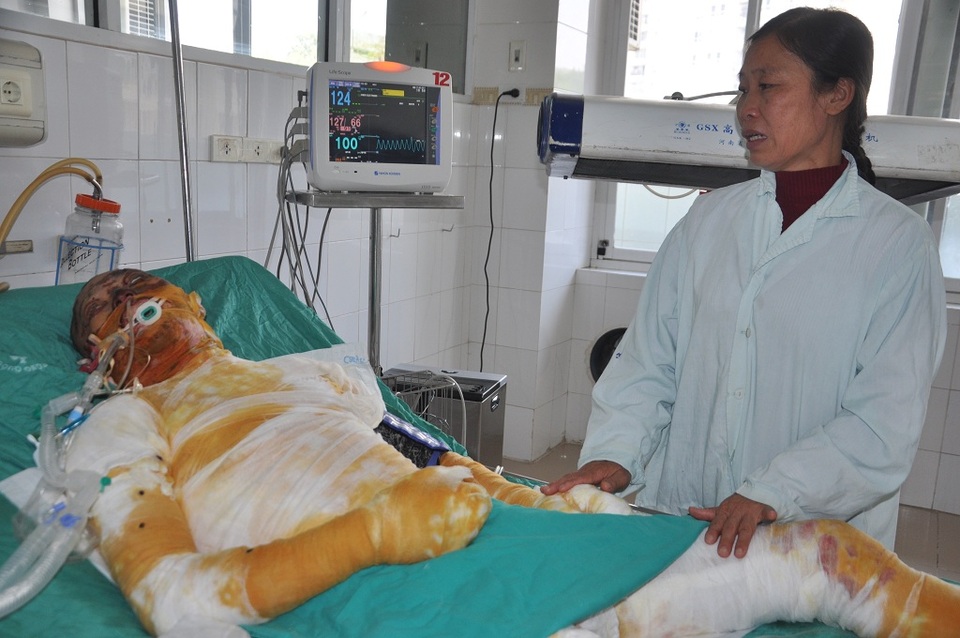 Vợ nghèo đau đớn cùng lúc nhận tin chồng ung thư, con bị bỏng nặng - 6 Không xoay đâu ra tiền để chữa cho con, chị Oanh sợ sẽ mất con mãi mãi.