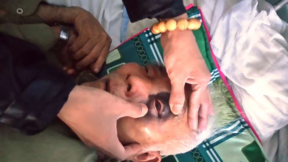 Thầy giáo hành hung đôi vợ chồng già phải nhập viện - 1 Ông Đằng bị thương nặng ở vùng mặt