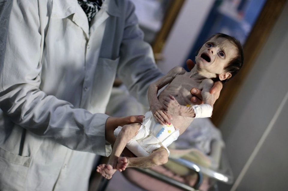 Xuất hiện hình ảnh em bé Syria bé nhỏ như chim khóc vì đói khiến thế giới thắt lòng - 1 Xuất hiện hình ảnh em bé Syria bé nhỏ như chim khóc vì đói khiến thế giới thắt lòng - 1