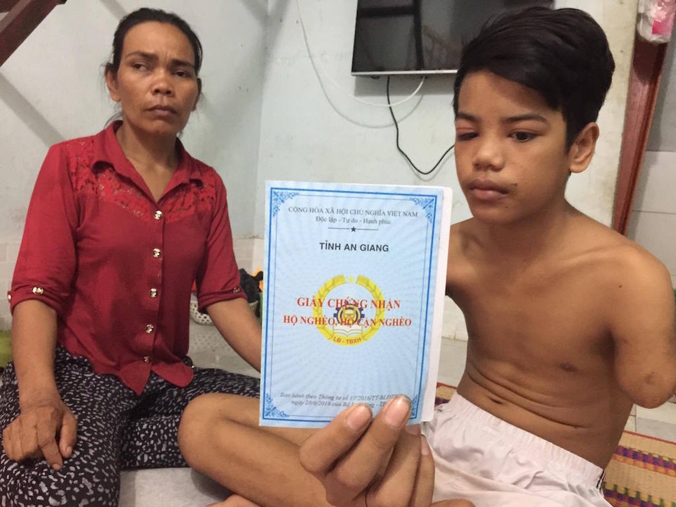 Cậu bé 15 tuổi đi làm công nhân, bị máy cán đứt lìa cánh tay - 1
Em Chau Konl bị đứt 1 cánh tay khi làm công nhân giày cho Công ty Hoa Việt.