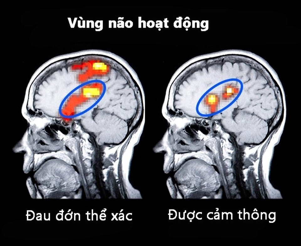 7 mẹo cải thiện tâm trạng theo các chuyên gia - 4 7 mẹo cải thiện tâm trạng theo các chuyên gia - 4