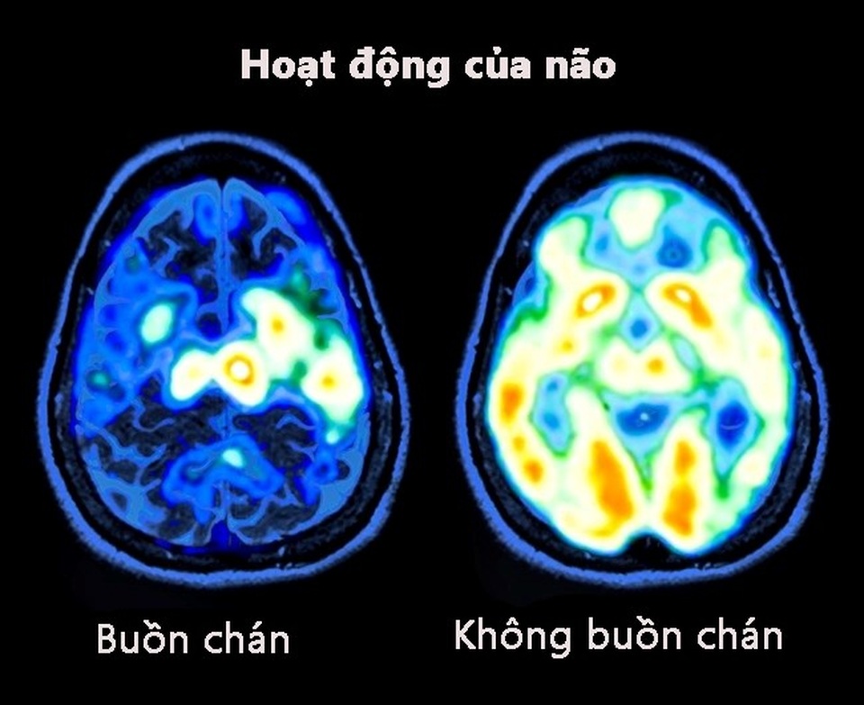 7 mẹo cải thiện tâm trạng theo các chuyên gia - 1 7 mẹo cải thiện tâm trạng theo các chuyên gia - 1